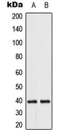 Rabbit Polyclonal Antibody to DUSP1/4
