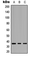 Rabbit Polyclonal Antibody to GPCR19