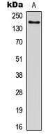 Rabbit Polyclonal Antibody to LPHN1
