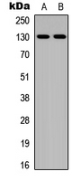 Rabbit Polyclonal Antibody to JMY