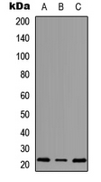Rabbit Polyclonal Antibody to MRPS18A