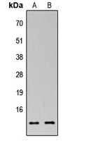 Rabbit Polyclonal Antibody to MRPS33