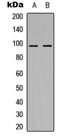 Rabbit Polyclonal Antibody to NOM1