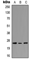 Rabbit Polyclonal Antibody to PEX11G