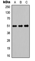 Rabbit Polyclonal Antibody to POTEA