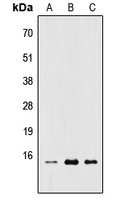 Rabbit Polyclonal Antibody to RPL22