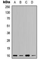Rabbit Polyclonal Antibody to RPL37A
