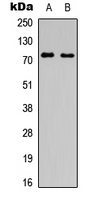 Rabbit Polyclonal Antibody to SLC6A16