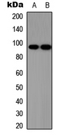 Rabbit Polyclonal Antibody to SOX6