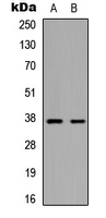 Rabbit Polyclonal Antibody to 44990