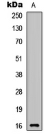 Rabbit Polyclonal Antibody to C17