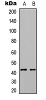 Rabbit Polyclonal Antibody to ABHD7