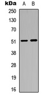 Rabbit Polyclonal Antibody to GABRA6