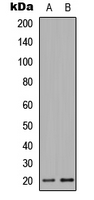 Rabbit Polyclonal Antibody to MRPL51