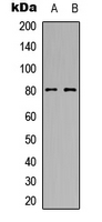 Rabbit Polyclonal Antibody to MTA1
