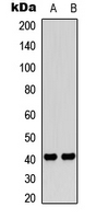 Rabbit Polyclonal Antibody to PAR4