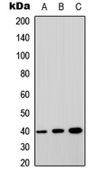 Rabbit Polyclonal Antibody to GPRC5A