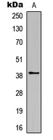 Rabbit Polyclonal Antibody to Rhodopsin