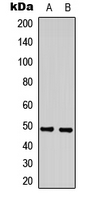Rabbit Polyclonal Antibody to SAP49