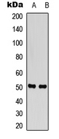 Rabbit Polyclonal Antibody to SNAT2