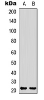 Rabbit Polyclonal Antibody to RB3