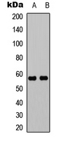 Rabbit Polyclonal Antibody to UBXN11