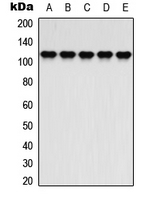 Rabbit Polyclonal Antibody to ATP1A2