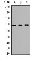 Rabbit Polyclonal Antibody to ZNF7