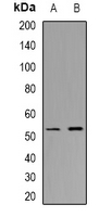 Rabbit Polyclonal Antibody to CHST9