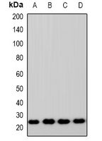 Rabbit Polyclonal Antibody to ZNRF2