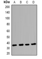 Rabbit Polyclonal Antibody to Claudin 17