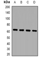 Rabbit Polyclonal Antibody to ZNF307