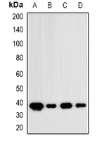 Rabbit Polyclonal Antibody to IDH3 alpha
