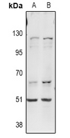 Rabbit Polyclonal Antibody to ITPKA