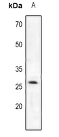 Rabbit Polyclonal Antibody to Trypsin 2