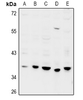 Rabbit Polyclonal Antibody to GPRC5D