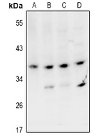 Rabbit Polyclonal Antibody to VPS26B