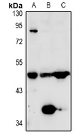 Rabbit Polyclonal Antibody to TAFI