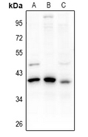 Rabbit Polyclonal Antibody to PDIK1L