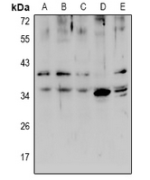 Rabbit Polyclonal Antibody to ZIP1
