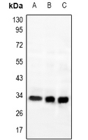 Rabbit Polyclonal Antibody to GPR169