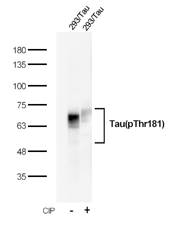 Rabbit Monoclonal Antibody to Recombinant Tau(Phospho-Thr181) Rabbit mAb(G69)