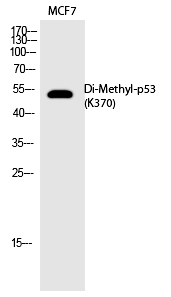 Rabbit Polyclonal Antibody to p53 (Di-Methyl-Lys370)