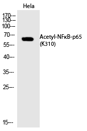 Rabbit Polyclonal Antibody to NFκB-p65 (Acetyl-Lys310)