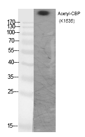 Rabbit Polyclonal Antibody to CBP (Acetyl-Lys1535)