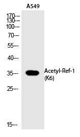 Rabbit Polyclonal Antibody to Ref-1 (Acetyl-Lys6)