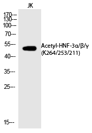 Rabbit Polyclonal Antibody to HNF-3α/β/γ (Acetyl-Lys264/253/211)