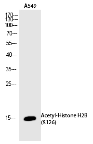Rabbit Polyclonal Antibody to Histone H2B (Acetyl-Lys126)