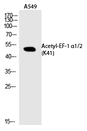 Rabbit Polyclonal Antibody to EF-1 α1/2 (Acetyl-Lys41)