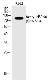 Rabbit Polyclonal Antibody to HSP 9(Acetyl-Lys292/284)